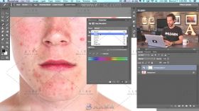 Photoshop祛痘祛斑打造完美肌肤视频教程