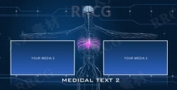 医疗保健人体解剖科技感展示动画AE模板