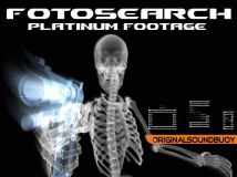 《形意骨架 视频素材》(Fotosearch Platinum Footage – X-Ray Vision)[网盘]